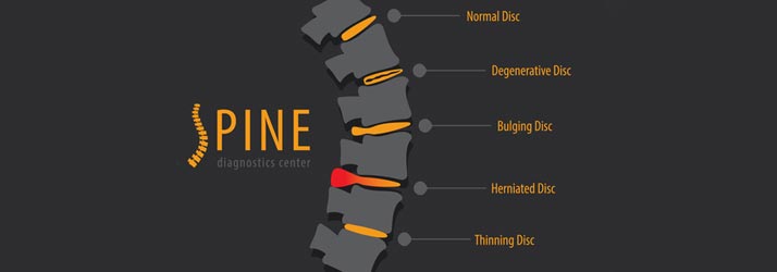 Levels of Chiropractic Care in Heath?