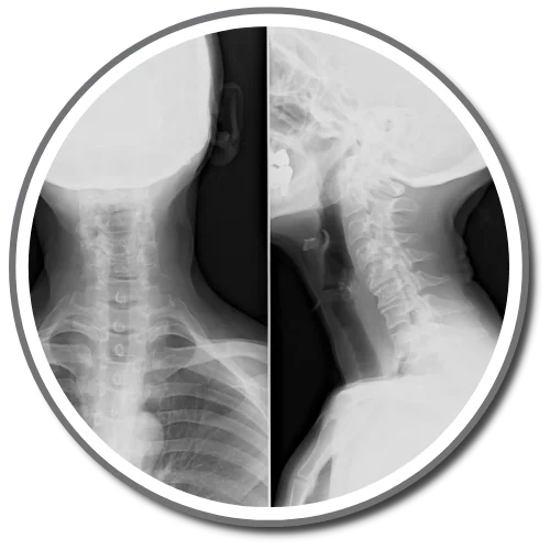 健康・医学 Gonstead Ajdjusting Equipment 5 Components of The Gonstead Technique - Chiropractor Heath